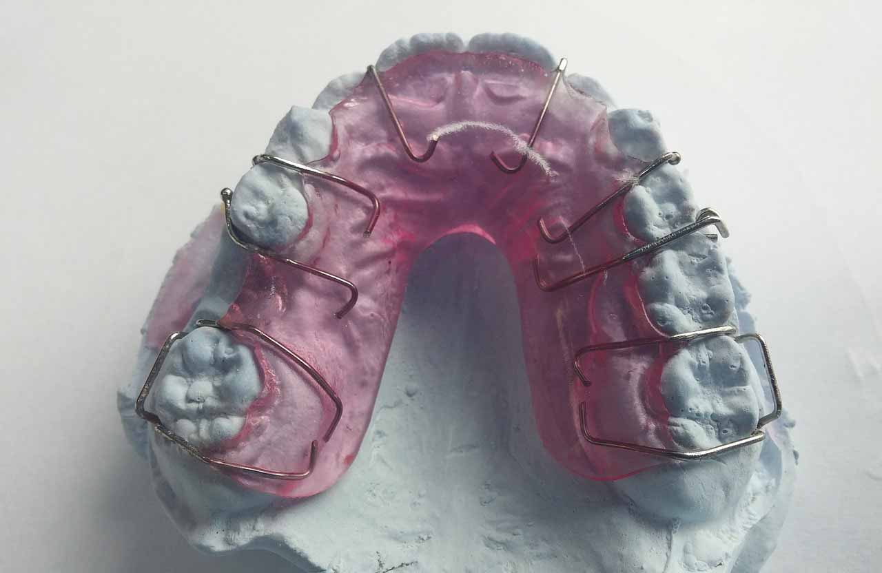 ortodoncia funcional
