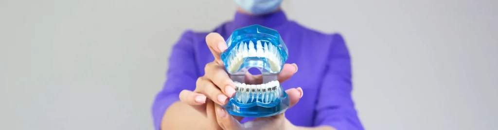La ortodoncia es el tratamiento ideal para corregir los problemas de alineación dental