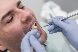 piorrea dental, causas y tratamientos