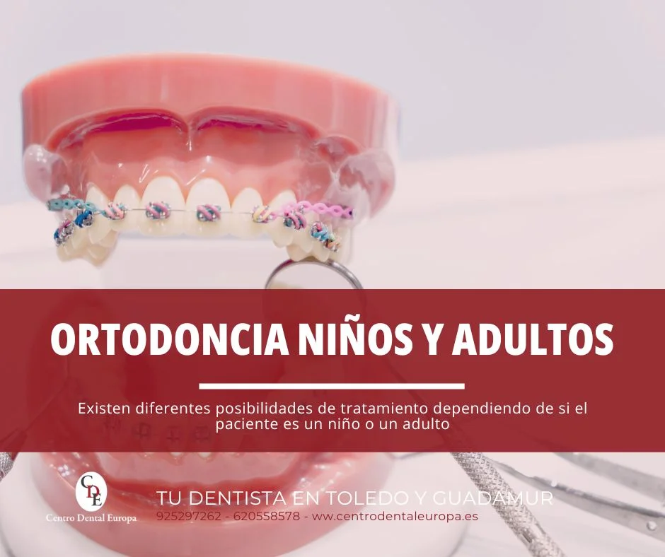 Diferencia ortodoncia niños y adultos