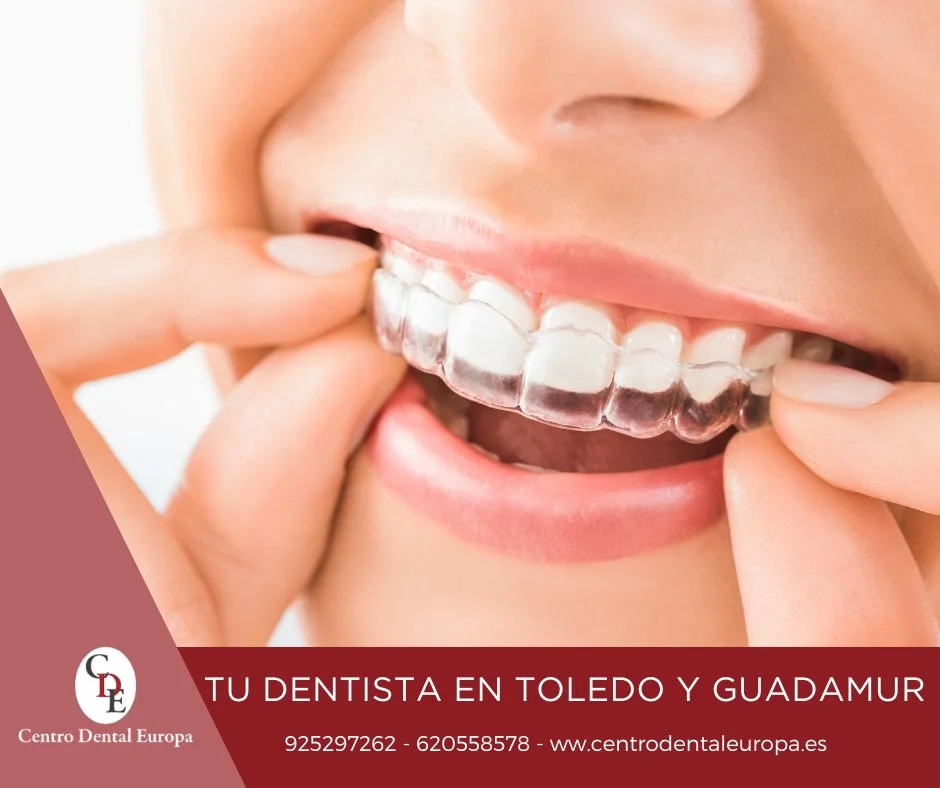 Tratamiento de ortodoncia toledo