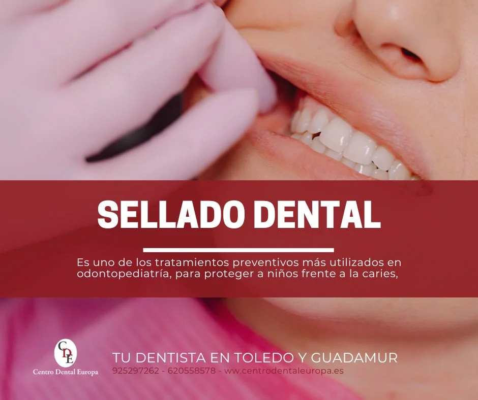 sellado dental